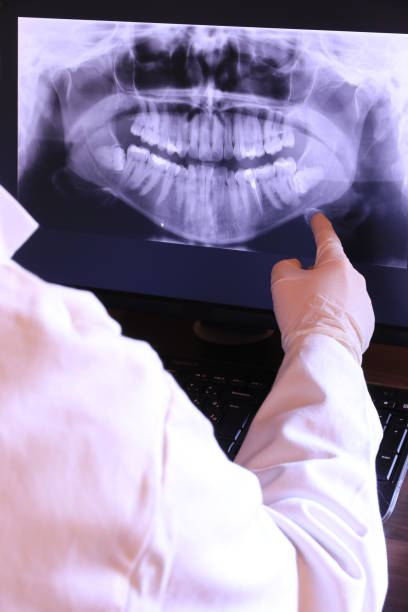 Best Broken or Cracked Tooth Emergency Dentist in Wildwood, NJ