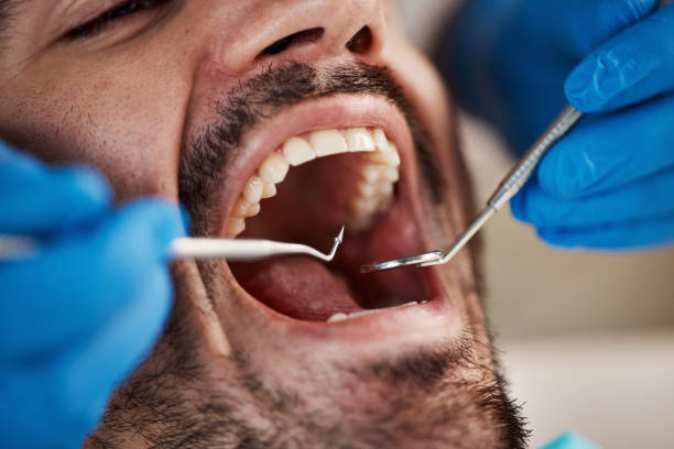 Best Urgent Dental Care for Toothache in Wildwood, NJ